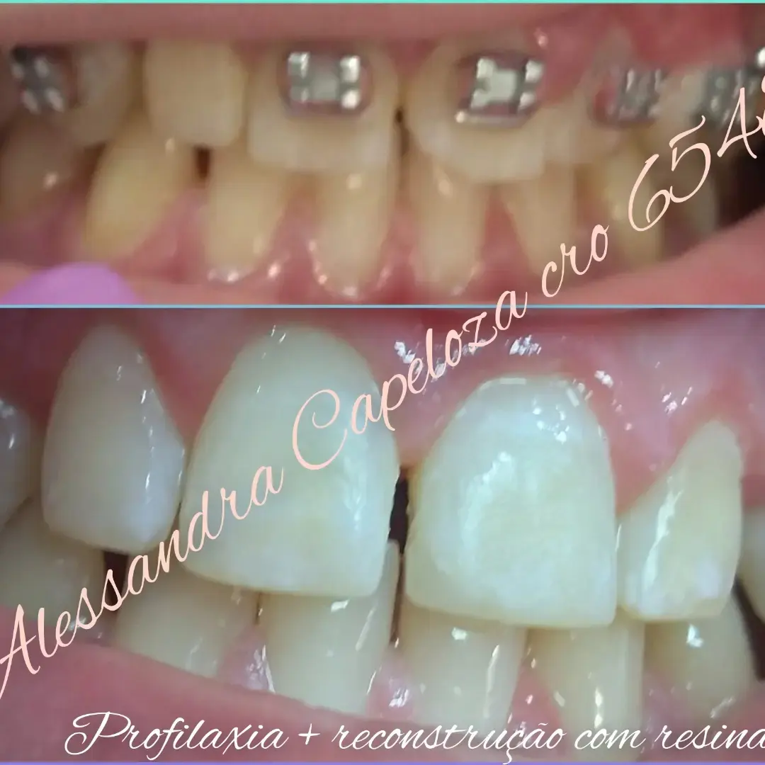 Correção de Formato (antes e depois)